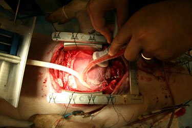 medSnake in the operating room